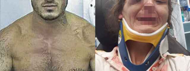 La brutal paliza que el boxeador Arnau propinó a su novia de Mallorca: "Casi me mata"